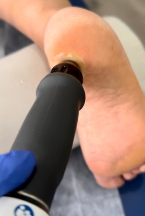 tratamientos de fisioterapia